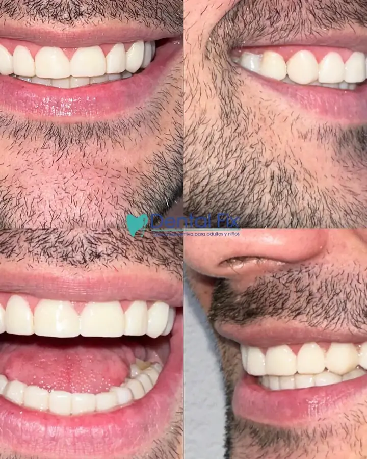 El actor Germán Valdés en el consultorio DentalFix