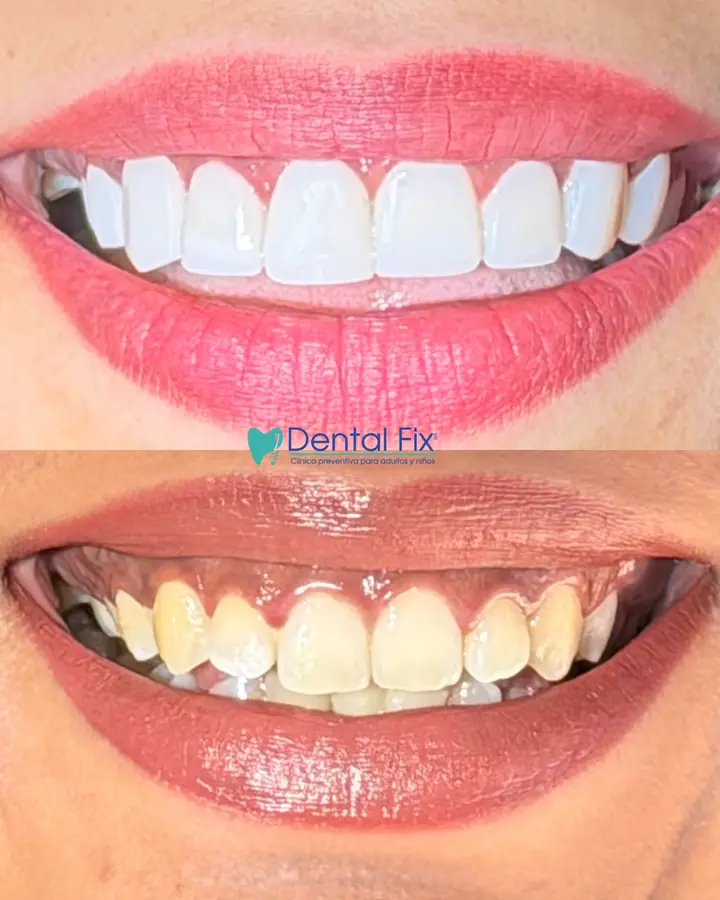Planeación digital de diseño de sonrisa en consultorio dental de CDMX