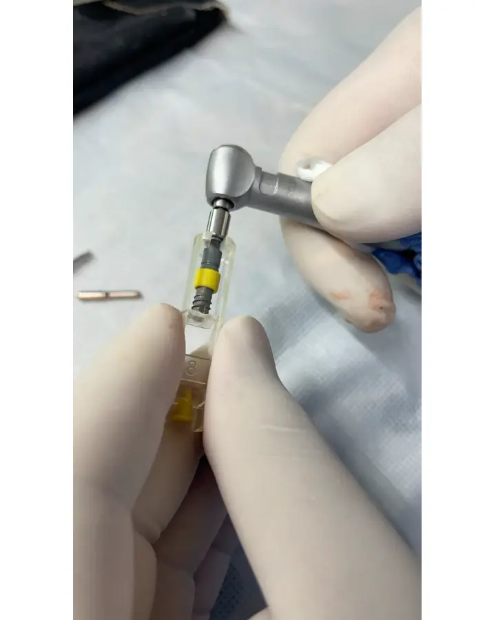 Pieza de un implante dental de titanio antes de colocarse