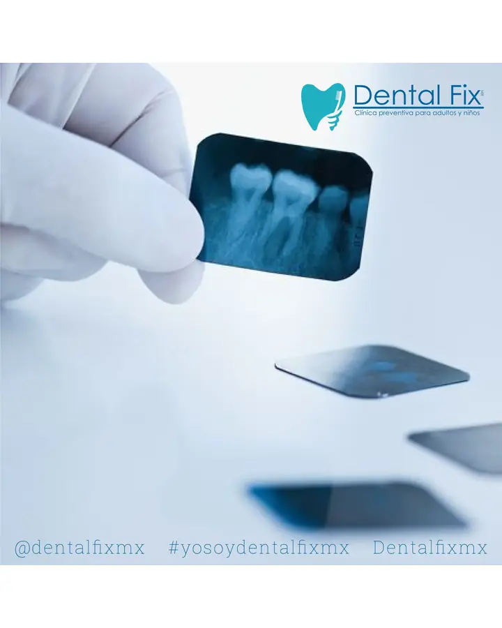 Radiografía periapical usada para el diagnóstico dental