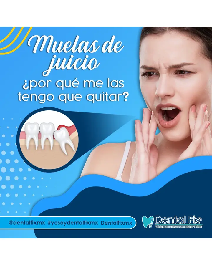 Explicación sobre por qué se extraen las muelas del juicio
